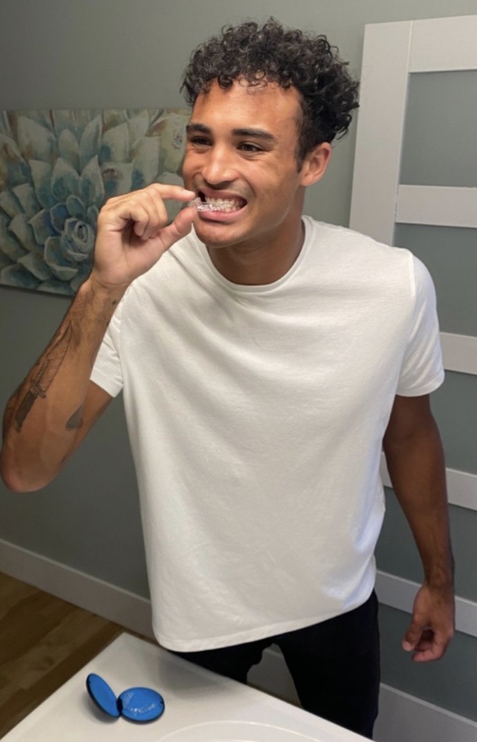 How to Clean Invisalign Aligners: Expert Tips - Freeman Orthodontics