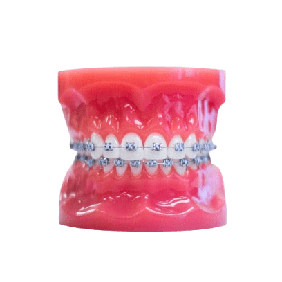 freeman-orthodontics-metal-braces-fort-lauderdale